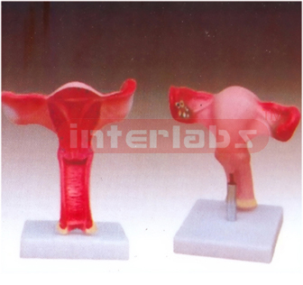 Magnified Uterus Model